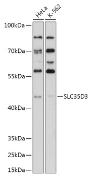 Western blot analysis of extracts of various cell lines, using SLC35D3 antibody (TA381652) at 1:1000 dilution. - Secondary antibody: HRP Goat Anti-Rabbit IgG (H+L) at 1:10000 dilution. - Lysates/proteins: 25ug per lane. - Blocking buffer: 3% nonfat dry milk in TBST. - Detection: ECL Enhanced Kit . - Exposure time: 90s.