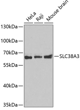 Western blot analysis of extracts of various cell lines, using SLC38A3 antibody (TA381656). - Secondary antibody: HRP Goat Anti-Rabbit IgG (H+L) at 1:10000 dilution. - Lysates/proteins: 25ug per lane. - Blocking buffer: 3% nonfat dry milk in TBST.
