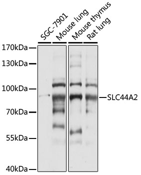Western blot analysis of extracts of various cell lines, using SLC44A2 antibody (TA381665) at 1:1000 dilution. - Secondary antibody: HRP Goat Anti-Rabbit IgG (H+L) at 1:10000 dilution. - Lysates/proteins: 25ug per lane. - Blocking buffer: 3% nonfat dry milk in TBST. - Detection: ECL Basic Kit . - Exposure time: 5s.