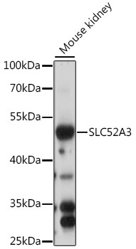Western blot analysis of extracts of mouse kidney, using SLC52A3 antibody (TA381678) at 1:1000 dilution. - Secondary antibody: HRP Goat Anti-Rabbit IgG (H+L) at 1:10000 dilution. - Lysates/proteins: 25ug per lane. - Blocking buffer: 3% nonfat dry milk in TBST. - Detection: ECL Basic Kit . - Exposure time: 60s.