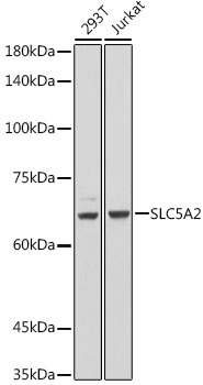 Western blot analysis of extracts of various cell lines, using SLC5A2 antibody (TA381682) at 1:1000 dilution. - Secondary antibody: HRP Goat Anti-Rabbit IgG (H+L) at 1:10000 dilution. - Lysates/proteins: 25ug per lane. - Blocking buffer: 3% nonfat dry milk in TBST. - Detection: ECL Basic Kit . - Exposure time: 1s.