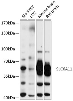 Western blot analysis of extracts of various cell lines, using SLC6A11 antibody (TA381689) at 1:3000 dilution. - Secondary antibody: HRP Goat Anti-Rabbit IgG (H+L) at 1:10000 dilution. - Lysates/proteins: 25ug per lane. - Blocking buffer: 3% nonfat dry milk in TBST. - Detection: ECL Basic Kit . - Exposure time: 5s.
