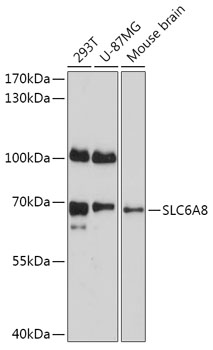 Western blot analysis of extracts of various cell lines, using SLC6A8 antibody (TA381699) at 1:1000 dilution. - Secondary antibody: HRP Goat Anti-Rabbit IgG (H+L) at 1:10000 dilution. - Lysates/proteins: 25ug per lane. - Blocking buffer: 3% nonfat dry milk in TBST. - Detection: ECL Basic Kit . - Exposure time: 30s.