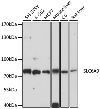 Western blot analysis of extracts of various cell lines, using SLC6A9 antibody (TA381700) at 1:1000 dilution. - Secondary antibody: HRP Goat Anti-Rabbit IgG (H+L) at 1:10000 dilution. - Lysates/proteins: 25ug per lane. - Blocking buffer: 3% nonfat dry milk in TBST. - Detection: ECL Basic Kit . - Exposure time: 10s.