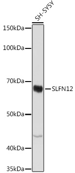 Western blot analysis of extracts of SH-SY5Y cells, using SLFN12 antibody (TA381725) at 1:1000 dilution. - Secondary antibody: HRP Goat Anti-Rabbit IgG (H+L) at 1:10000 dilution. - Lysates/proteins: 25ug per lane. - Blocking buffer: 3% nonfat dry milk in TBST. - Detection: ECL Basic Kit . - Exposure time: 3s.