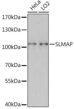 Western blot analysis of extracts of various cell lines, using SLMAP Rabbit pAb (TA381732) at 1:3000 dilution. - Secondary antibody: HRP Goat Anti-Rabbit IgG (H+L) at 1:10000 dilution. - Lysates/proteins: 25ug per lane. - Blocking buffer: 3% nonfat dry milk in TBST. - Detection: ECL Basic Kit . - Exposure time: 90s.