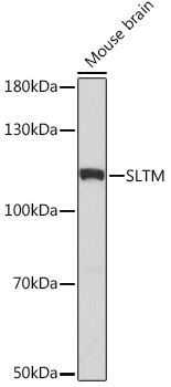 Western blot analysis of extracts of Mouse brain, using SLTM Rabbit pAb (TA381734) at 1:1000 dilution. - Secondary antibody: HRP Goat Anti-Rabbit IgG (H+L) at 1:10000 dilution. - Lysates/proteins: 25ug per lane. - Blocking buffer: 3% nonfat dry milk in TBST. - Detection: ECL Basic Kit . - Exposure time: 30s.