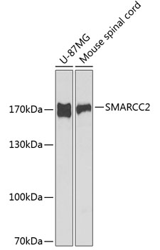 Western blot analysis of extracts of various cell lines, using SMARCC2 antibody (TA381762) at 1:1000 dilution._Secondary antibody: HRP Goat Anti-Rabbit IgG (H+L) at 1:10000 dilution._Lysates/proteins: 25ug per lane._Blocking buffer: 3% nonfat dry milk in TBST._Detection: ECL Enhanced Kit ._Exposure time: 60s.