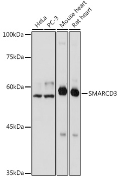 Apoptosis induced in JURKAT human T cell leukemia cell line by soluble recombinant human TRAIL is completely blocked by anti-human TRAIL (2E5). The neutralizing activity of the antibody 2E5 has been confirmed with various sources of soluble recombinant human TRAIL. A - medium B - recombinant TRAIL C - recombinant TRAIL + anti-human TRAIL (2E5; 0.06 ug/ml) D - recombinant TRAIL + anti-human TRAIL (2E5; 0.24 ug/ml) E - recombinant TRAIL + Isotype mouse IgG1 control