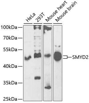 Western blot analysis of extracts of various cell lines, using SMYD2 antibody (TA381805) at 1:1000 dilution. - Secondary antibody: HRP Goat Anti-Rabbit IgG (H+L) at 1:10000 dilution. - Lysates/proteins: 25ug per lane. - Blocking buffer: 3% nonfat dry milk in TBST. - Detection: ECL Basic Kit . - Exposure time: 60s.