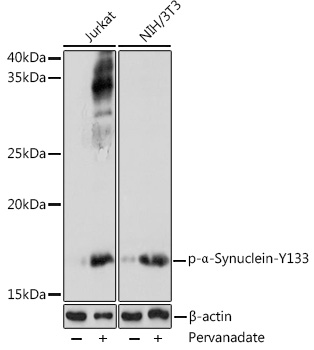 Surface staining of human peripheral blood cells with anti-CD177 (MEM-166) purified, GAM-APC.