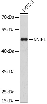 SM2011F Human Macrophages antibody -FITC Staining of Human peripheral blood gran ulocytes.