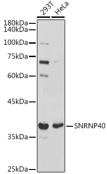 Western blot analysis of extracts of various cell lines, using SNRNP40 antibody (TA381837) at 1:1000 dilution. - Secondary antibody: HRP Goat Anti-Rabbit IgG (H+L) at 1:10000 dilution. - Lysates/proteins: 25ug per lane. - Blocking buffer: 3% nonfat dry milk in TBST. - Detection: ECL Basic Kit . - Exposure time: 1s.
