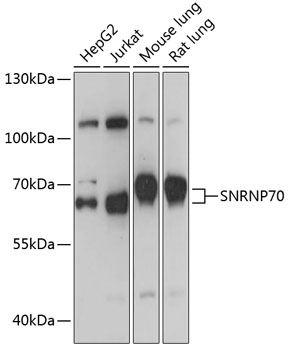 Western blot analysis of HeLa whole cell lysate (Lane 1) and HeLa heat stressed whole cell lysate (Lane 2) probed with Rat anti CCT theta Cat.-No SM2017P followed by F (ab')2 Rabbit anti Rat IgG:HRP (Cat.-No SP1021HRP).