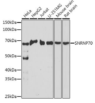 Western blot analysis of HeLa whole cell lysate (lane 1) and HeLa heat stressed whole cell lysate (lane 2) probed with rat anti CCT Eta Cat.-No. SM2019P followed by F (ab')2 rabbit anti rat IgG:HRP (Cat.No. SP1021HRP).