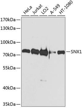 Western blot analysis of extracts of various cell lines, using SNX1 antibody (TA381854) at 1:1000 dilution. - Secondary antibody: HRP Goat Anti-Rabbit IgG (H+L) at 1:10000 dilution. - Lysates/proteins: 25ug per lane. - Blocking buffer: 3% nonfat dry milk in TBST. - Detection: ECL Basic Kit . - Exposure time: 1s.