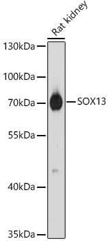 Western blot analysis of extracts of Rat kidney, using SOX13 antibody (TA381890) at 1:1000 dilution. - Secondary antibody: HRP Goat Anti-Rabbit IgG (H+L) at 1:10000 dilution. - Lysates/proteins: 25ug per lane. - Blocking buffer: 3% nonfat dry milk in TBST. - Detection: ECL Basic Kit . - Exposure time: 30s.