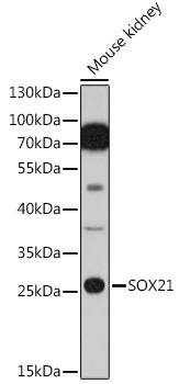Western blot analysis of extracts of Mouse kidney cells, using SOX21 antibody (TA381897) at 1:1000 dilution. - Secondary antibody: HRP Goat Anti-Rabbit IgG (H+L) at 1:10000 dilution. - Lysates/proteins: 25ug per lane. - Blocking buffer: 3% nonfat dry milk in TBST. - Detection: ECL Basic Kit . - Exposure time: 60s.