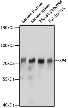 Western blot analysis of extracts of various cell lines, using SP4 antibody (TA381909) at 1:1000 dilution. - Secondary antibody: HRP Goat Anti-Rabbit IgG (H+L) at 1:10000 dilution. - Lysates/proteins: 25ug per lane. - Blocking buffer: 3% nonfat dry milk in TBST. - Detection: ECL Basic Kit . - Exposure time: 1s.