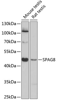 Western blot analysis of extracts of various cell lines, using SPAG8 antibody (TA381914) at 1:3000 dilution. - Secondary antibody: HRP Goat Anti-Rabbit IgG (H+L) at 1:10000 dilution. - Lysates/proteins: 25ug per lane. - Blocking buffer: 3% nonfat dry milk in TBST. - Detection: ECL Basic Kit . - Exposure time: 90s.