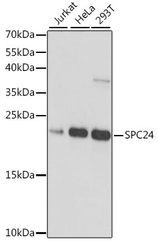 Western blot analysis of extracts of various cell lines, using SPC24 antibody (TA381921) at 1:1000 dilution. - Secondary antibody: HRP Goat Anti-Rabbit IgG (H+L) at 1:10000 dilution. - Lysates/proteins: 25ug per lane. - Blocking buffer: 3% nonfat dry milk in TBST. - Detection: ECL Basic Kit . - Exposure time: 30s.