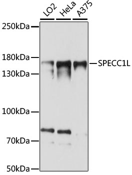 Western blot analysis of extracts of various cell lines, using SPECC1L antibody (TA381925) at 1:1000 dilution. - Secondary antibody: HRP Goat Anti-Rabbit IgG (H+L) at 1:10000 dilution. - Lysates/proteins: 25ug per lane. - Blocking buffer: 3% nonfat dry milk in TBST. - Detection: ECL Basic Kit . - Exposure time: 15s.