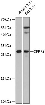 Western blot analysis of extracts of various cell lines, using SPRR3 antibody (TA381961) at 1:3000 dilution. - Secondary antibody: HRP Goat Anti-Rabbit IgG (H+L) at 1:10000 dilution. - Lysates/proteins: 25ug per lane. - Blocking buffer: 3% nonfat dry milk in TBST. - Detection: ECL Basic Kit . - Exposure time: 90s.