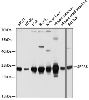 Western blot analysis of extracts of various cell lines, using SRPRB antibody (TA382011) at 1:1000 dilution. - Secondary antibody: HRP Goat Anti-Rabbit IgG (H+L) at 1:10000 dilution. - Lysates/proteins: 25ug per lane. - Blocking buffer: 3% nonfat dry milk in TBST. - Detection: ECL Basic Kit . - Exposure time: 5s.