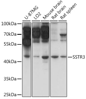 Western blot analysis of extracts of various cell lines, using SSTR3 antibody (TA382048) at 1:1000 dilution. - Secondary antibody: HRP Goat Anti-Rabbit IgG (H+L) at 1:10000 dilution. - Lysates/proteins: 25ug per lane. - Blocking buffer: 3% nonfat dry milk in TBST. - Detection: ECL Basic Kit . - Exposure time: 1s.