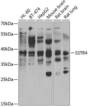 Western blot analysis of extracts of various cell lines, using SSTR4 antibody (TA382049) at 1:1000 dilution._Secondary antibody: HRP Goat Anti-Rabbit IgG (H+L) at 1:10000 dilution._Lysates/proteins: 25ug per lane._Blocking buffer: 3% nonfat dry milk in TBST._Detection: ECL Enhanced Kit ._Exposure time: 300s.