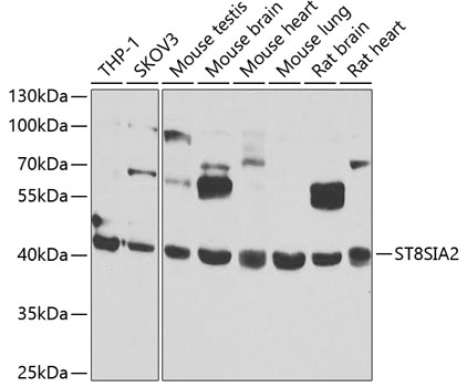 Western blot analysis of extracts of various cell lines, using ST8SIA2 antibody (TA382070) at 1:1000 dilution. - Secondary antibody: HRP Goat Anti-Rabbit IgG (H+L) at 1:10000 dilution. - Lysates/proteins: 25ug per lane. - Blocking buffer: 3% nonfat dry milk in TBST. - Detection: ECL Basic Kit . - Exposure time: 30s.