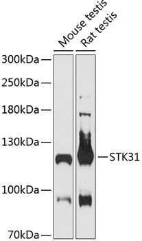 Western blot analysis of extracts of various cell lines, using STK31 antibody (TA382133) at 1:3000 dilution. - Secondary antibody: HRP Goat Anti-Rabbit IgG (H+L) at 1:10000 dilution. - Lysates/proteins: 25ug per lane. - Blocking buffer: 3% nonfat dry milk in TBST. - Detection: ECL Basic Kit . - Exposure time: 90s.