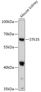 Western blot analysis of extracts of Mouse kidney, using STK35 antibody (TA382135) at 1:1000 dilution. - Secondary antibody: HRP Goat Anti-Rabbit IgG (H+L) at 1:10000 dilution. - Lysates/proteins: 25ug per lane. - Blocking buffer: 3% nonfat dry milk in TBST. - Detection: ECL Basic Kit . - Exposure time: 90s.