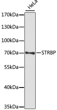 Western blot analysis of extracts of HeLa cells, using STRBP antibody (TA382153) at 1:1000 dilution. - Secondary antibody: HRP Goat Anti-Rabbit IgG (H+L) at 1:10000 dilution. - Lysates/proteins: 25ug per lane. - Blocking buffer: 3% nonfat dry milk in TBST. - Detection: ECL Basic Kit . - Exposure time: 90s.