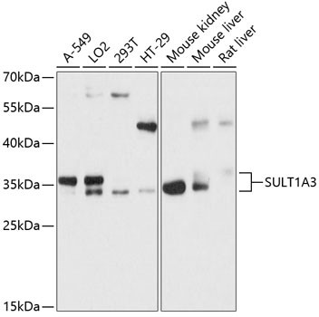 SM293R (MOUSE ANTI RAT CD161:RPE) staining of rat splenocytes.