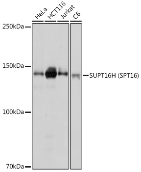 Western blot analysis of extracts of various cell lines, using SUPT16H (SPT16) antibody (TA382210) at 1:1000 dilution. - Secondary antibody: HRP Goat Anti-Rabbit IgG (H+L) at 1:10000 dilution. - Lysates/proteins: 25ug per lane. - Blocking buffer: 3% nonfat dry milk in TBST. - Detection: ECL Basic Kit . - Exposure time: 1s.