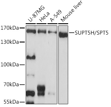 Western blot analysis of extracts of various cell lines, using SUPT5H/SPT5 antibody (TA382214) at 1:1000 dilution. - Secondary antibody: HRP Goat Anti-Rabbit IgG (H+L) at 1:10000 dilution. - Lysates/proteins: 25ug per lane. - Blocking buffer: 3% nonfat dry milk in TBST. - Detection: ECL Basic Kit . - Exposure time: 10s.