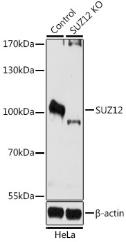 Fig. 1. Western Blotting analysis (non-reducing conditions) of over-expressed human CD14 using anti-CD14 (MEM-18). Lane 1: whole cell lysate HEK 293 transfected with empty vector; Lane 2: tissue c ulture supernatant collected after c ultivation of HEK 293 transfected with human CD14 cDNA; Lane 3: whole cell lysate of HEK 293 transfected with human CD14 cDNA