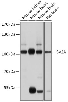 Western Blotting analysis (non-reducing conditions) of over-expressed Human CD14 using anti-CD14 antibody (Clone MEM-18). Lane 1: Whole cell lysate HEK 293 transfected with empty vector. Lane 2: Tissue c ulture supernatant collected after c ultivation of HEK 293 transfected with Human CD14 cDNA. Lane 3: Whole cell lysate of HEK 293 transfected with Human CD14 cDNA.