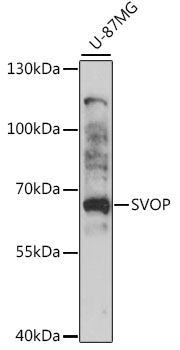 Surface staining of human peripheral blood leukocytes using anti-human CD14 (clone MEM-18) FITC.