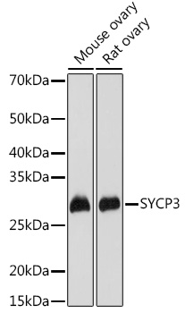 Western blot analysis of extracts of various cell lines, using SYCP3 antibody (TA382230) at 1:1000 dilution. - Secondary antibody: HRP Goat Anti-Rabbit IgG (H+L) at 1:10000 dilution. - Lysates/proteins: 25ug per lane. - Blocking buffer: 3% nonfat dry milk in TBST. - Detection: ECL Basic Kit . - Exposure time: 30s.