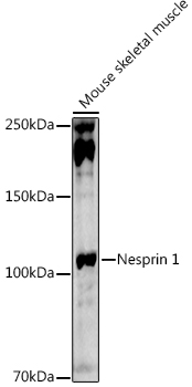 Western blot analysis of extracts of Mouse skeletal muscle, using Nesprin 1 antibody (TA382238) at 1:1000 dilution. - Secondary antibody: HRP Goat Anti-Rabbit IgG (H+L) at 1:10000 dilution. - Lysates/proteins: 25ug per lane. - Blocking buffer: 3% nonfat dry milk in TBST. - Detection: ECL Basic Kit . - Exposure time: 90s.