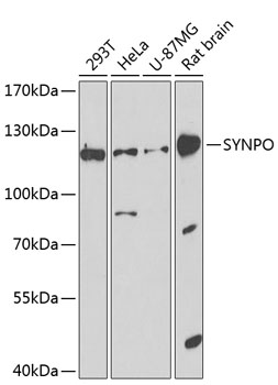 Surface staining of PHA-stim ulated (3 days) human PBMC with anti-CD25 (MEM-181) APC.