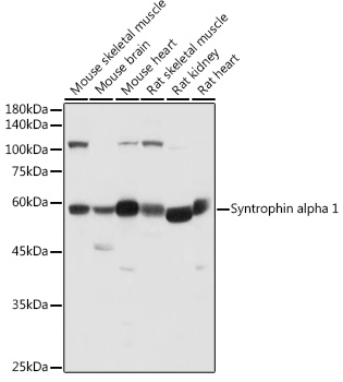 Western blot analysis of extracts of various cell lines, using Syntrophin alpha 1 antibody (TA382249) at 1:500 dilution. - Secondary antibody: HRP Goat Anti-Rabbit IgG (H+L) at 1:10000 dilution. - Lysates/proteins: 25ug per lane. - Blocking buffer: 3% nonfat dry milk in TBST. - Detection: ECL Basic Kit . - Exposure time: 1s.