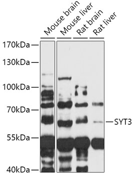 Western blot analysis of extracts of various cell lines, using SYT3 antibody (TA382255) at 1:1000 dilution. - Secondary antibody: HRP Goat Anti-Rabbit IgG (H+L) at 1:10000 dilution. - Lysates/proteins: 25ug per lane. - Blocking buffer: 3% nonfat dry milk in TBST. - Detection: ECL Basic Kit . - Exposure time: 90s.