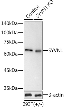 Surface staining of CD3 in human peripheral blood with anti-CD3 (MEM-57) PerCP.