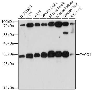Western blot analysis of extracts of various cell lines, using TACO1 antibody (TA382268) at 1:1000 dilution. - Secondary antibody: HRP Goat Anti-Rabbit IgG (H+L) at 1:10000 dilution. - Lysates/proteins: 25ug per lane. - Blocking buffer: 3% nonfat dry milk in TBST. - Detection: ECL Basic Kit . - Exposure time: 90s.