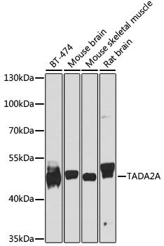Western blot analysis of extracts of various cell lines, using TADA2A antibody (TA382272) at 1:1000 dilution. - Secondary antibody: HRP Goat Anti-Rabbit IgG (H+L) at 1:10000 dilution. - Lysates/proteins: 25ug per lane. - Blocking buffer: 3% nonfat dry milk in TBST. - Detection: ECL Enhanced Kit . - Exposure time: 10s.