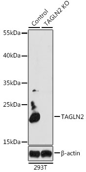 Western blot analysis (non-reducing conditions) of isolated peripheral blood lymphocytes of various species using anti-CD44 (MEM-263). Lane 1: lysate of human PBL Lane 2: lysate of canine PBL Lane 3: lysate of porcine PBL