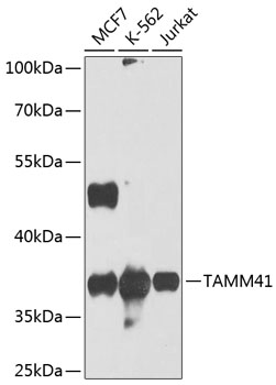Western blot analysis of extracts of various cell lines, using TAMM41 antibody (TA382295) at 1:1000 dilution. - Secondary antibody: HRP Goat Anti-Rabbit IgG (H+L) at 1:10000 dilution. - Lysates/proteins: 25ug per lane. - Blocking buffer: 3% nonfat dry milk in TBST. - Detection: ECL Basic Kit . - Exposure time: 10s.